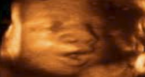 9-BABY-IN-THE-WOMB